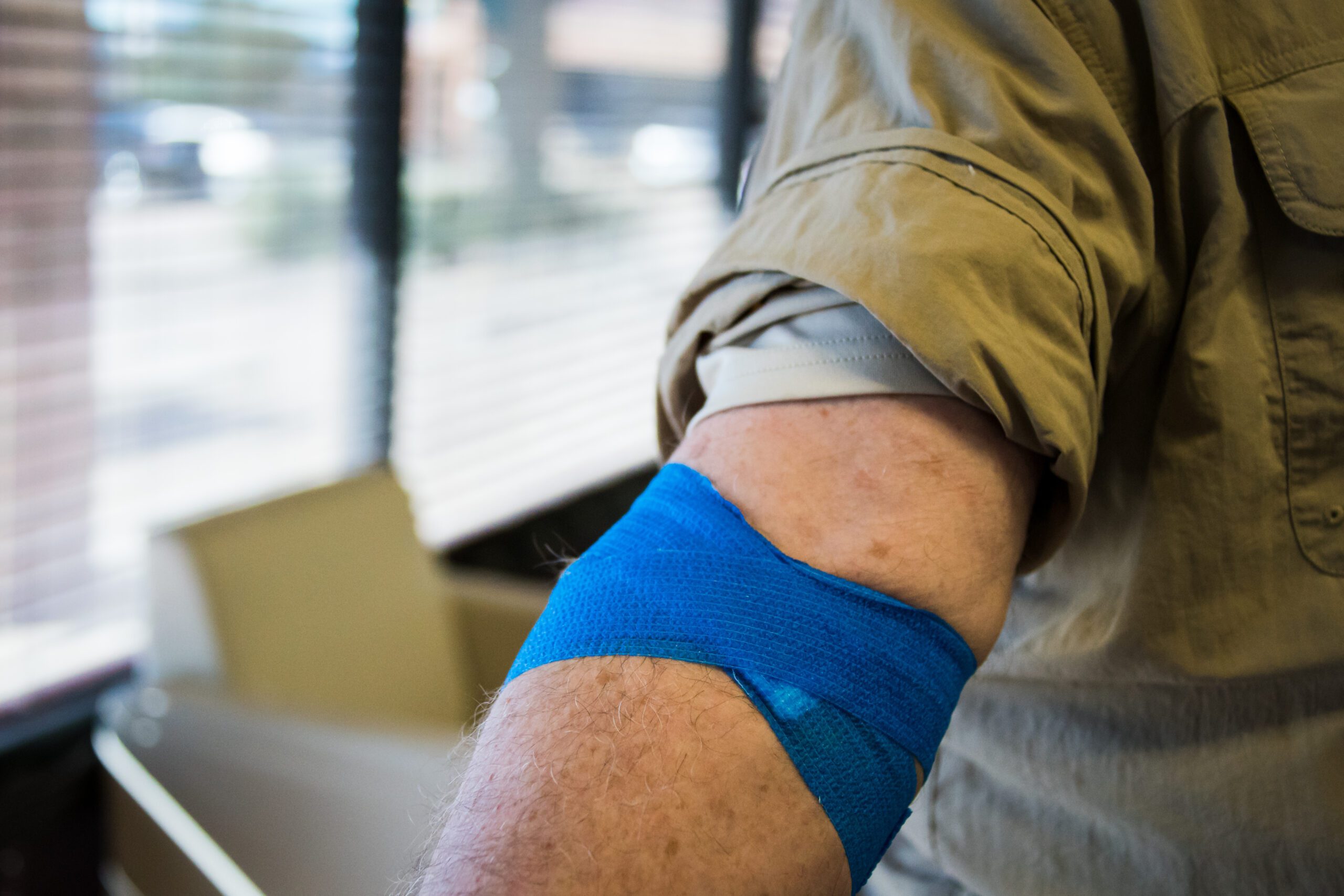 Donor Arm After Donation