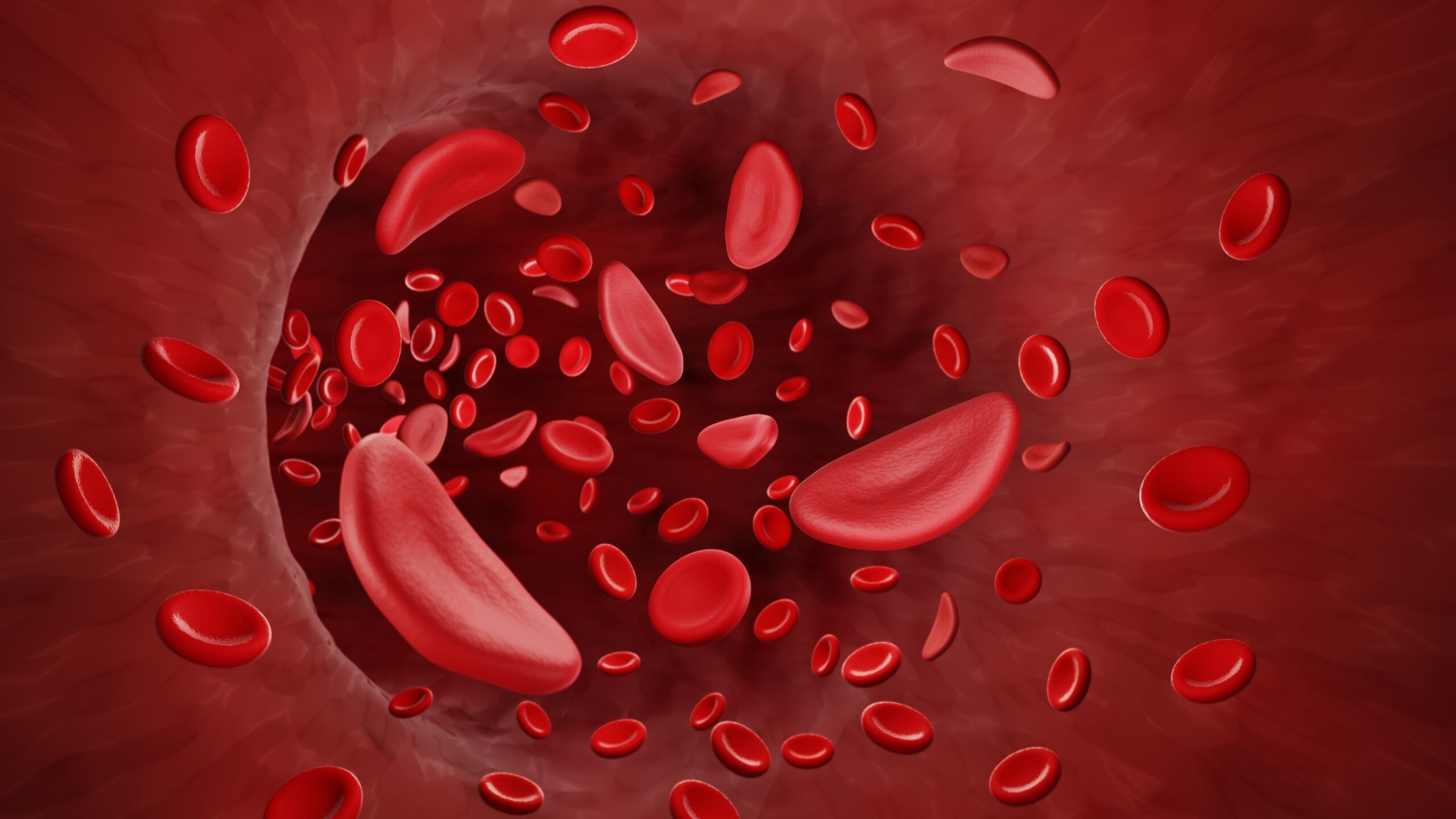 Sickle Cell Awareness Month highlights importance of donor diversity